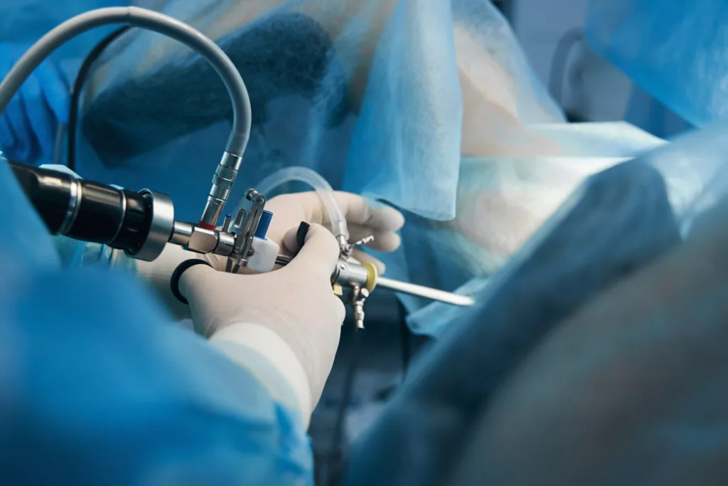 Arthroscopie coude - Dr Samuel Poulain - Chirurgien Orthopédiste à Dieppe & Rouen